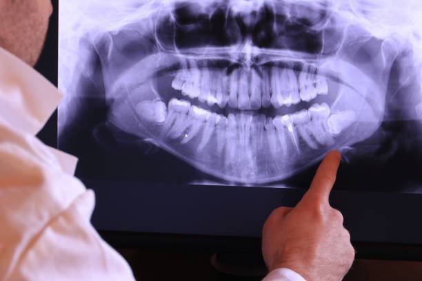 Best Emergency Dental Care for Broken or Chipped Teeth in Platteville, CO